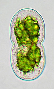 Cosmarium thwaitesii